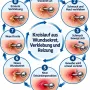 kreislauf_piercing_wundsekret_faq_handy_480.webp